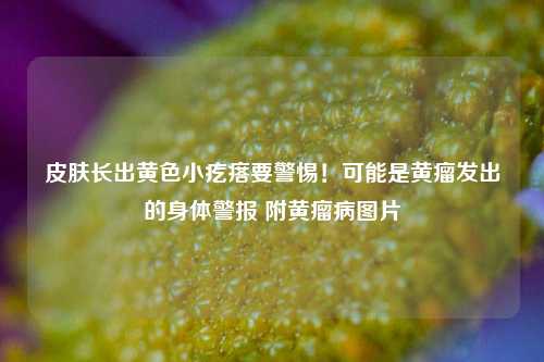 皮肤长出黄色小疙瘩要警惕！可能是黄瘤发出的身体警报 附黄瘤病图片