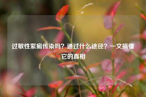 过敏性紫癜传染吗？通过什么途径？一文搞懂它的真相